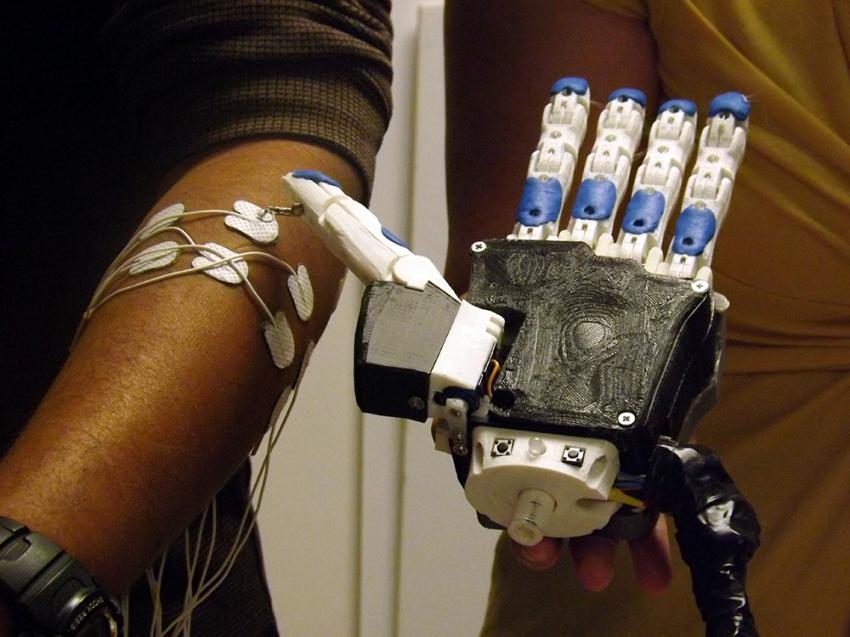 Illinois Students Target Developing Nations with 3D Printed Prosthetic Hand Which Learns Users' Movements