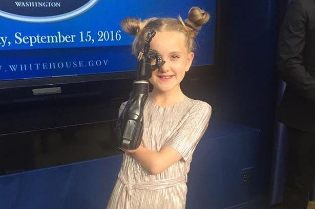 Resilient Young Girl Tests Open Bionics' 3D Printed Superhero Prosthetic Hands
