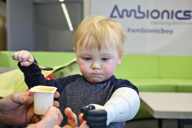 Father 3D Prints Unique Hydraulic Prosthetic Arm for Infant Son and Wants to Share the Technology with Babies Around the World