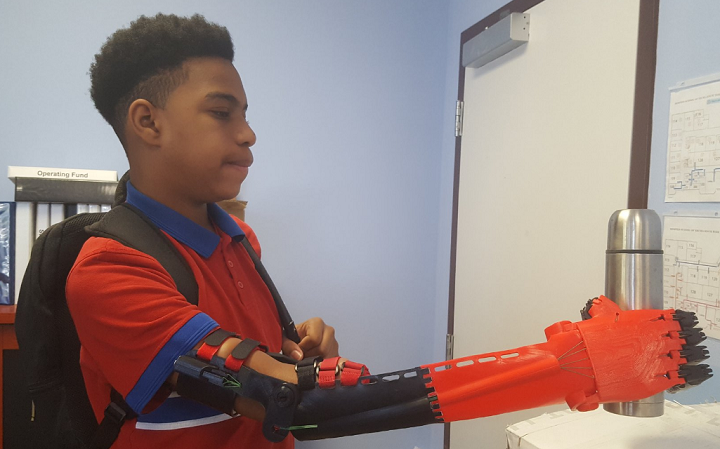 Tennessee Charter School Teachers 3D Print Prosthetic Arm for 8th Grade Student Basketball Player
