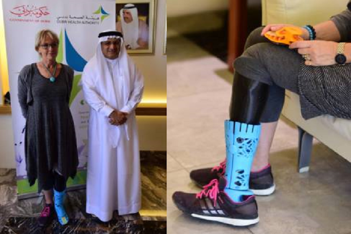 The UAE's First Fully 3D Printed Prosthetic Leg Fitted: Recipient "Really Impressed" with Technology That Made It Possible