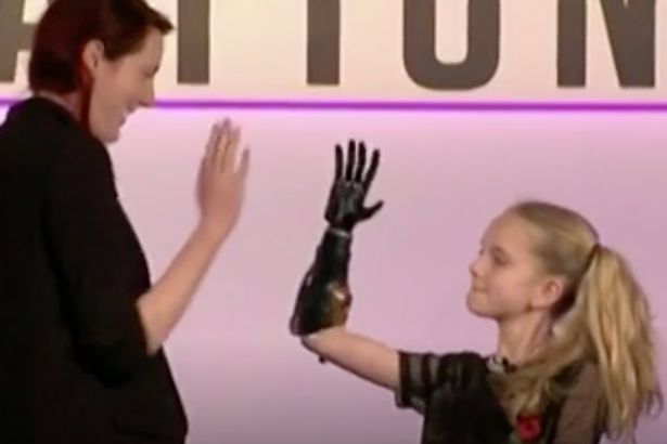 World's First Clinical Trial of 3D Printed Bionic Hands for Children Begins in UK