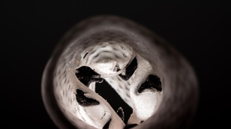3D Printed Metamaterials Used for Patient-Specific Heart Valve Models May Help Cardiac Patients