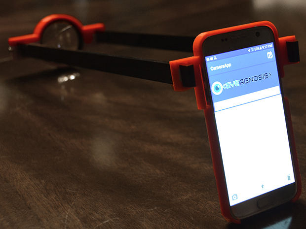 Teenager Uses AI, a 3D Printed Lens, and a Smartphone to Develop Portable System to Diagnose a Common Eye Disease