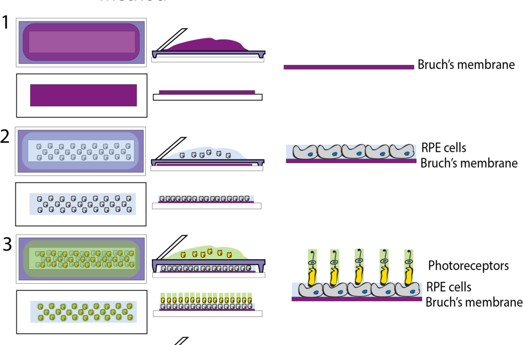 $90,000 Awarded to Developers of 3D Printed Retinal Model
