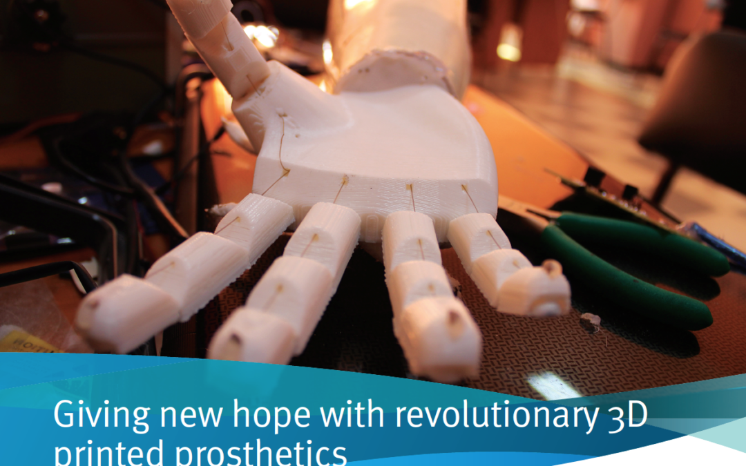 Son Creates 3D Printed Prosthetic Arm for Father with Help from DSM Somos