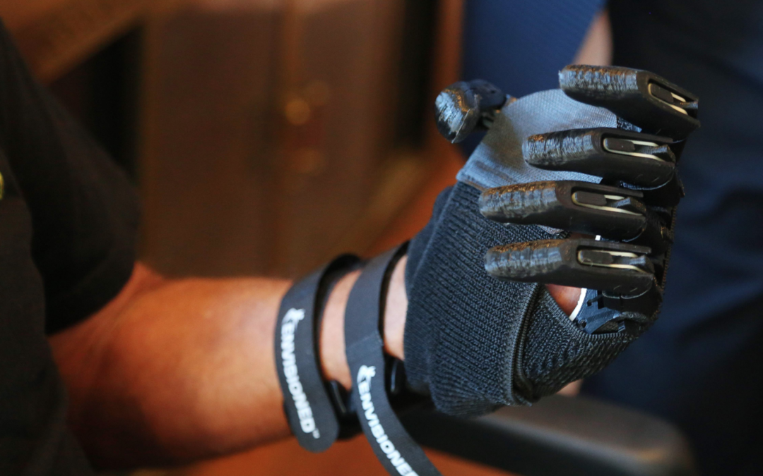Florida Man Receives New 3D Printed Hands From e-NABLE