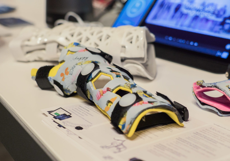 Israeli Surgeons Use 3D Printed Surgical Guide to Correct Madelung's Deformity
