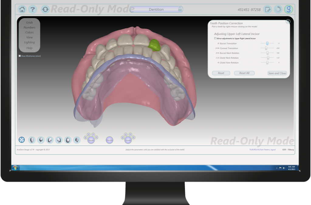 EnvisionTEC and AvaDent Partner to Deliver 3D Printed Denture Solutions