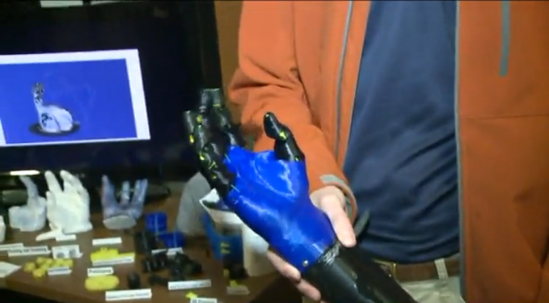 Missouri Teen 3D Prints Prosthetic Arm for His Dad