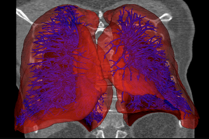 Aether Announces New AI 3D Medical Imaging Software, Partnership with Harvard Medical School to Advance Organ 3D Printing