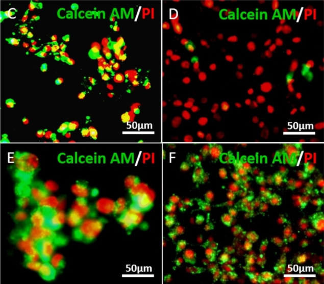 3D Bioprinted Brain Tumors Help Researchers Gain Ground on Aggressive Form of Cancer