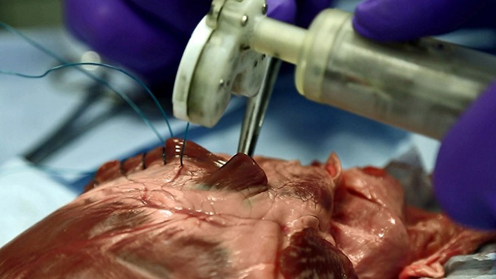 Sutrue Introduces Two 3D Printed Automated Suture Stitching Devices
